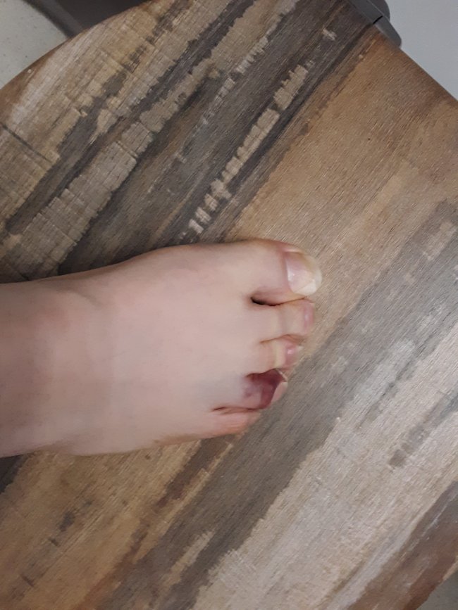 TOE.jpg